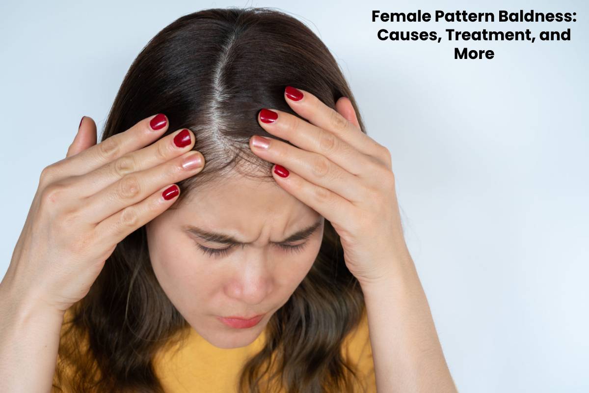 Female Pattern Baldness Causes Treatment And More
